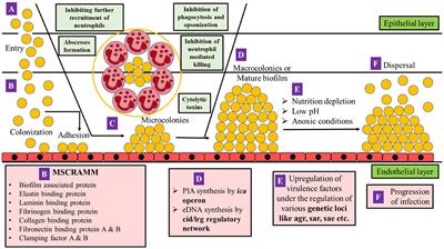 A genetic regulatory see-saw of biofilm and virulence in MRSA pathogenesis
